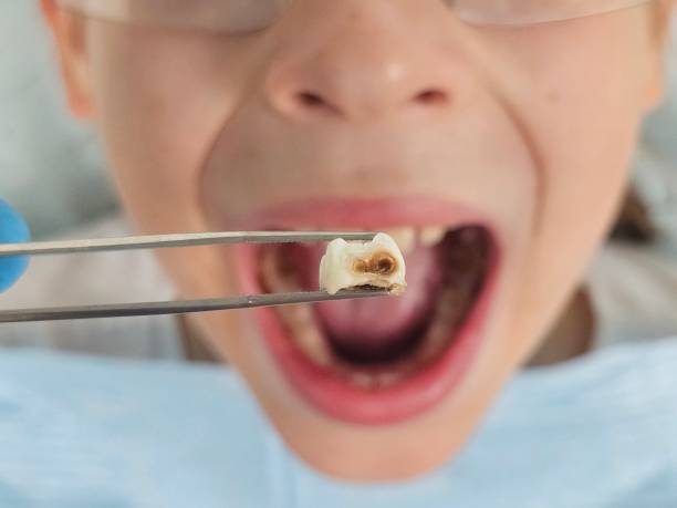 Fast & Reliable Emergency Dental Services in RI