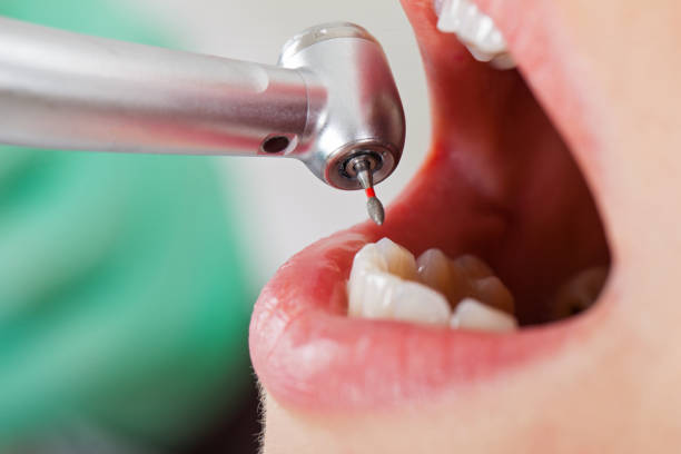 Best Emergency Broken Tooth Repair in Narragansett Pier, RI